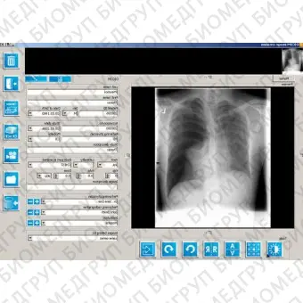 Программное обеспечение для медицинских снимков iQVIEW BASIC