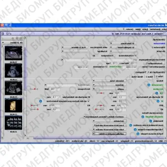 Медицинское программное обеспечение Gynaecology