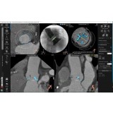 Медицинское программное обеспечение 3mensio Aortic valve