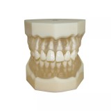 ЧВН-28УП - денто-модель верхней и нижней челюстей для практики удаления зубов